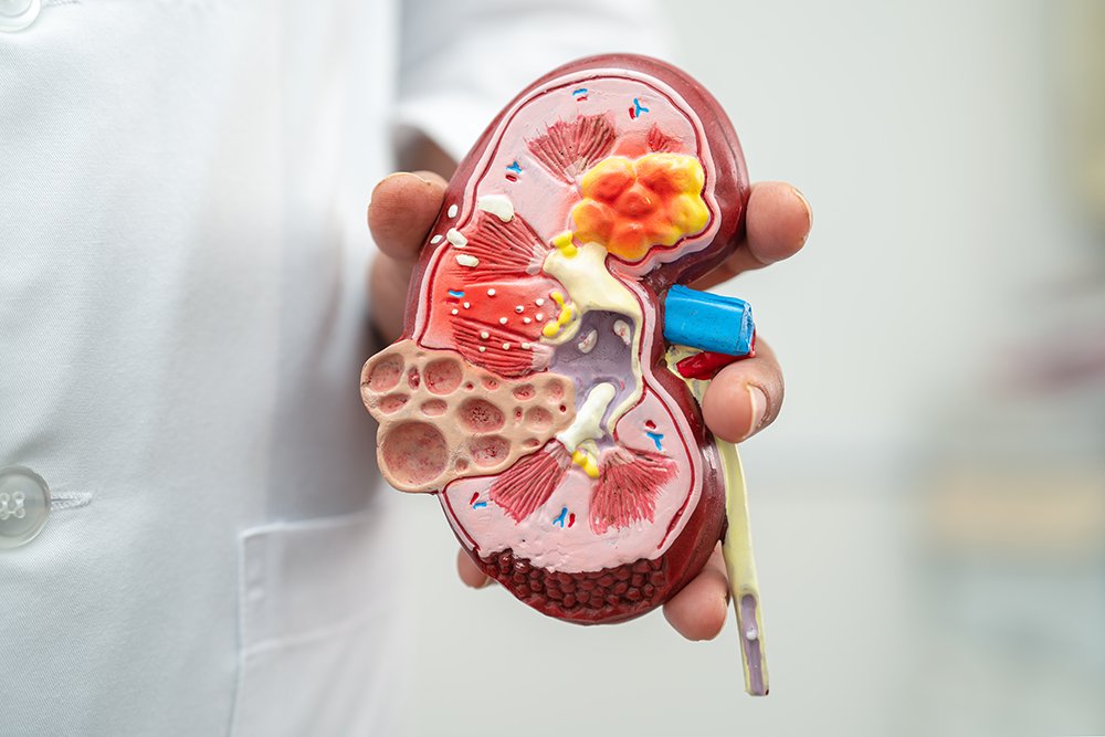 model of the kidney