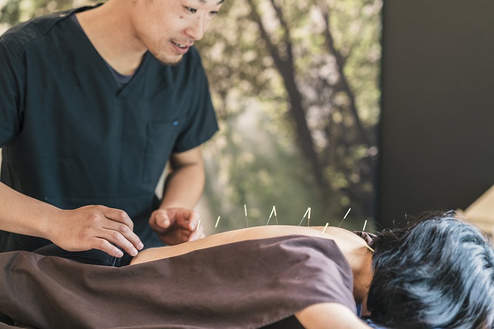 Managing Menopause with acupuncture