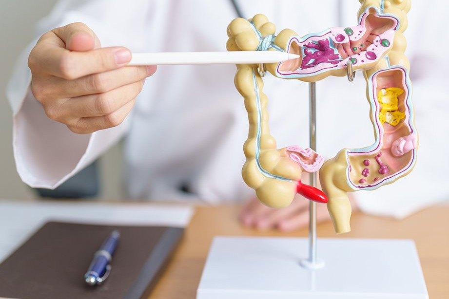 doctor with model of the gut